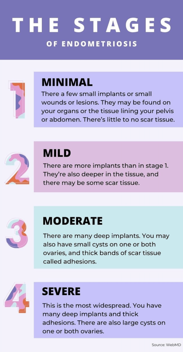 The stages of endometriosis